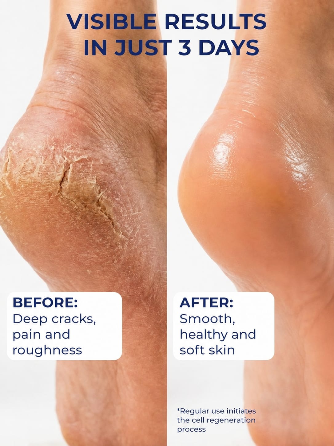 Fear Free Heel Crack Cream